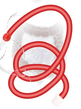 50/100cm Anal Washer Hose For Women Vaginal Shower Medical Butt Plug Men Enema Douche Pipe Erotic Sex Toys Adults Games Couples